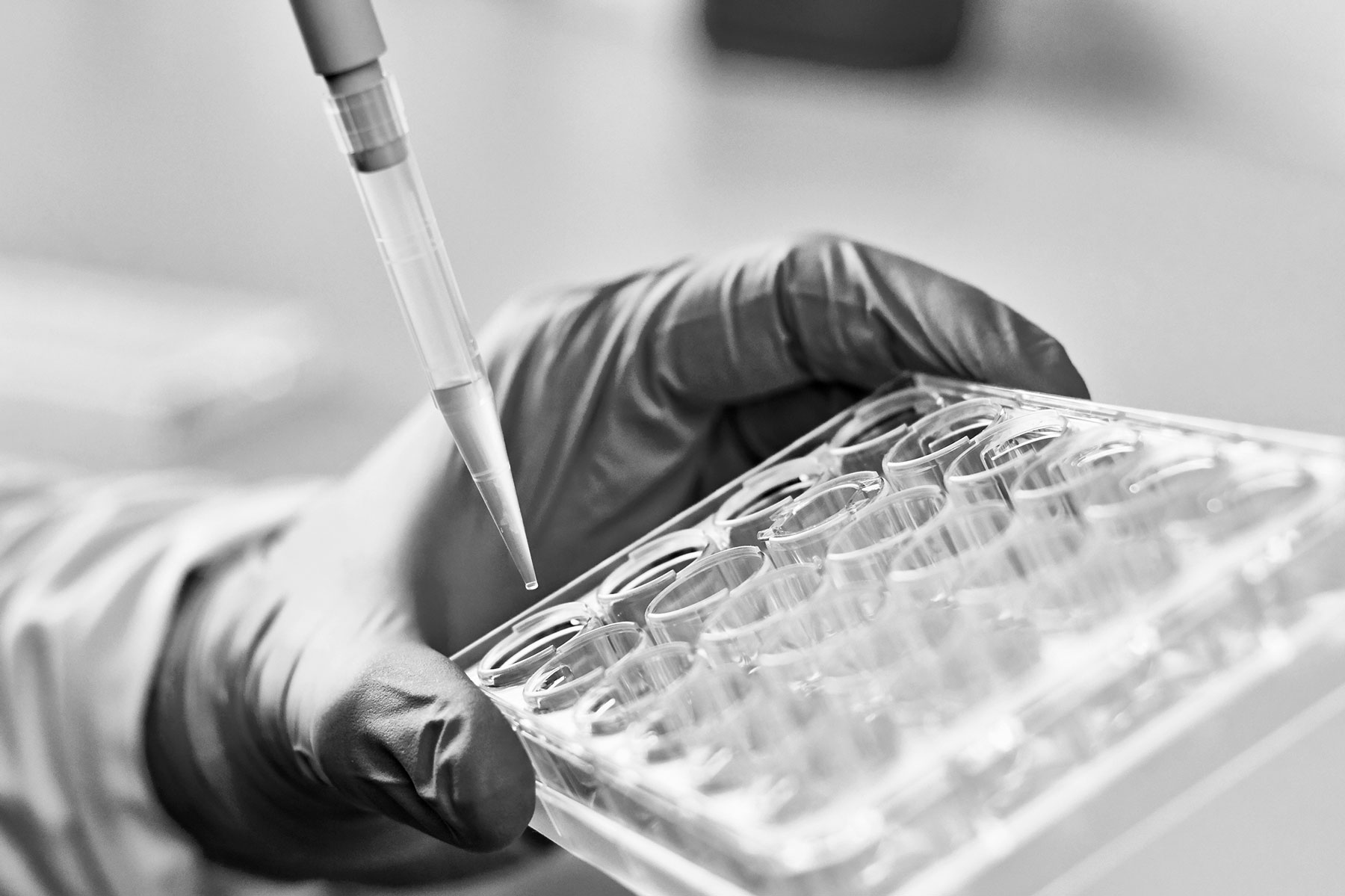 Prenatal DNA Testing 